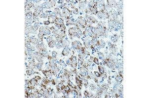 Immunohistochemistry (IHC) image for anti-B-Raf proto-oncogene, serine/threonine kinase (BRAF) (AA 350-449) antibody (ABIN7265818)