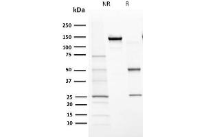 SDS-PAGE Analysis Purified Cytochrome P450 1A1/1A2 Mouse Monoclonal Antibody (MC1). (CYP1A1/2 antibody)