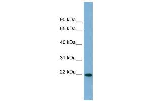 WB Suggested Anti-FNDC4 Antibody Titration:  0. (FNDC4 antibody  (Middle Region))
