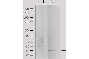 Western blot analysis of extracts from HepG2, using PHLA2 Antibody.