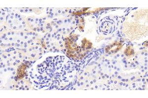 Detection of EFNB2 in Human Kidney Tissue using Polyclonal Antibody to Ephrin B2 (EFNB2) (Ephrin B2 antibody)