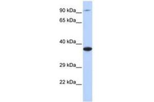 Image no. 1 for anti-Bardet-Biedl Syndrome 5 (BBS5) (C-Term) antibody (ABIN6741199) (BBS5 antibody  (C-Term))