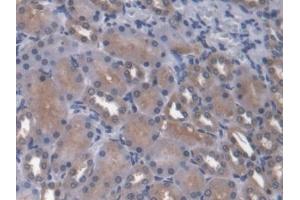IHC-P analysis of Rat Kidney Tissue, with DAB staining. (ANGPTL4 antibody  (AA 228-389))