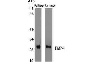 Western Blotting (WB) image for anti-TIMP Metallopeptidase Inhibitor 4 (TIMP4) (C-Term) antibody (ABIN3177728) (TIMP4 antibody  (C-Term))
