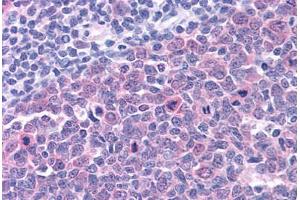 Human Tonsil: Formalin-Fixed, Paraffin-Embedded (FFPE) (SMARCA4 antibody  (C-Term))