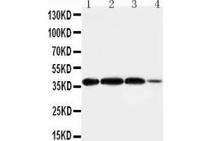 Anti-Arg2 antibody, Western blotting Lane 1: Rat Lung Tissue Lysate Lane 2: Rat Testis Tissue Lysate Lane 3: A549 Cell Lysate Lane 4:293T Cell Lysate (ARG2 antibody  (N-Term))