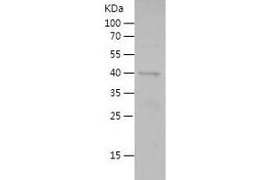 Western Blotting (WB) image for Lectin, Galactoside-Binding, Soluble, 9 (LGALS9) (AA 1-183) protein (His-IF2DI Tag) (ABIN7283821) (Galectin 9 Protein (AA 1-183) (His-IF2DI Tag))