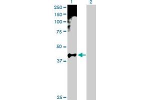 Western Blot analysis of HOXA11 expression in transfected 293T cell line by HOXA11 MaxPab polyclonal antibody. (Homeobox A11 antibody  (AA 1-313))