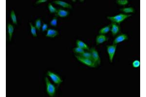 Immunofluorescent analysis of HepG2 cells using ABIN7171408 at dilution of 1:100 and Alexa Fluor 488-congugated AffiniPure Goat Anti-Rabbit IgG(H+L) (CD96 antibody  (AA 306-395))