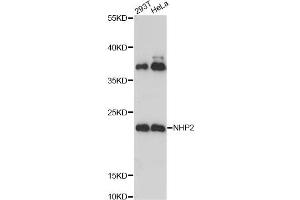 Western blot analysis of extracts of various cell lines, using NHP2 Antibody. (NHP2 antibody)