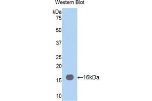Western blot analysis of the recombinant protein. (Fascin antibody  (AA 277-396))