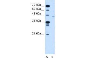 Western Blotting (WB) image for anti-Fukutin (FKTN) antibody (ABIN2464004)