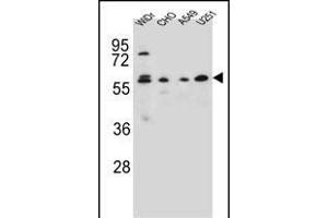 CEP70 Antibody (Center) (ABIN654603 and ABIN2844302) western blot analysis in WiDr,CHO,A549, cell line lysates (35 μg/lane). (CEP70 antibody  (AA 309-338))