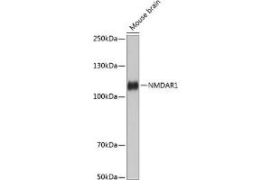 Western blot analysis of extracts of Mouse brain, using NMD Rabbit mAb (ABIN7267417) at 1:1000 dilution. (GRIN1/NMDAR1 antibody)