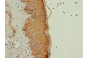 Immunohistochemistry of paraffin-embedded human skin tissue using ABIN7161905 at dilution of 1:100 (NR2E1 antibody  (AA 106-385))