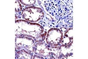 IL-6 antibody immunohistochemistry analysis in formalin fixed and paraffin embedded human kidney tissue. (IL-6 antibody  (AA 27-55))