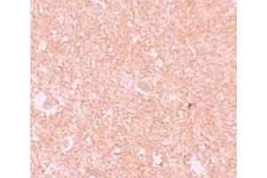 Immunohistochemical staining of human brain cells with NLRP10 polyclonal antibody  at 10 ug/mL. (NLRP10 antibody  (N-Term))
