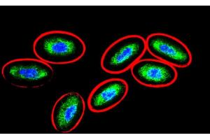 Immunofluorescence staining (chicken erythrocytes) (Vimentin antibody)