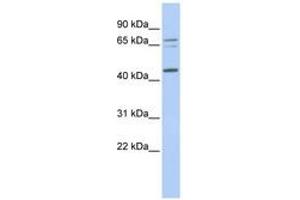 Image no. 1 for anti-Queuine tRNA-Ribosyltransferase 1 (QTRT1) (AA 252-301) antibody (ABIN6741051) (QTRT1 antibody  (AA 252-301))