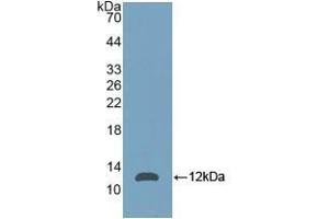 Detection of Recombinant NPM, Mouse using Polyclonal Antibody to Nucleophosmin 1 (NPM1) (NPM1 antibody  (AA 212-292))