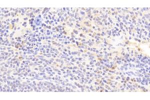 Detection of IL1RA in Rabbit Spleen Tissue using Polyclonal Antibody to Interleukin 1 Receptor Antagonist (IL1RA) (IL1RN antibody  (AA 26-177))
