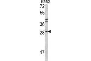 Western Blotting (WB) image for anti-Integrin beta 1 Binding Protein 3 (ITGB1BP3) antibody (ABIN3001631)