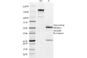 SDS-PAGE (SDS) image for anti-Fc Fragment of IgG, Low Affinity IIa, Receptor (CD32) (FCGR2A) antibody (ABIN6939374)