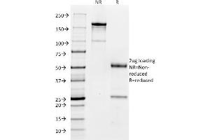 SDS-PAGE Analysis Purified CD32 Mouse Monoclonal Antibody (FCGR2A/479). (FCGR2A antibody)