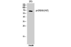 Western Blotting (WB) image for anti-Growth Factor Receptor-Bound Protein 10 (GRB10) (pTyr67) antibody (ABIN3179603) (GRB10 antibody  (pTyr67))