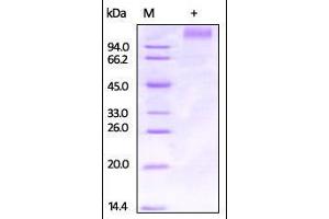 Ebolavirus EBOV (subtype Zaire,strain Kikwit-95) GP1 on SDS-PAGE under reducing (R) condition. (Glycoprotein / GP (Virus) (AA 33-501) protein (His tag))