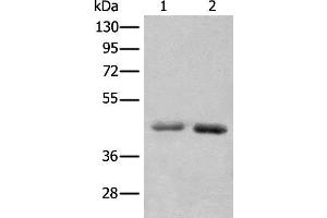 Western blot analysis of A549 and Hela cell lysates using NADK2 Polyclonal Antibody at dilution of 1:1000 (NADK2 antibody)