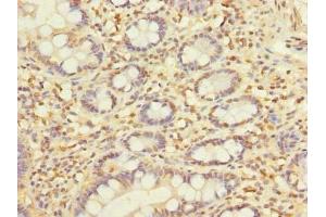 Immunohistochemistry of paraffin-embedded human small intestine tissue using ABIN7145334 at dilution of 1:100 (SLC22A18AS antibody  (AA 1-150))