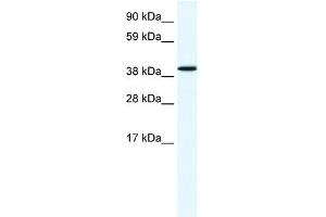 WB Suggested Anti-ANXA7 Antibody Titration:  1. (Annexin VII antibody  (N-Term))