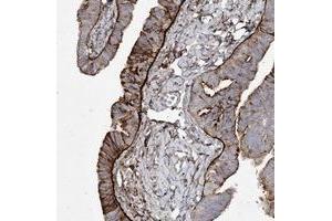 Immunohistochemical staining of human fallopian tube with LDLRAD3 polyclonal antibody  shows strong cytoplasmic and membranous positivity in glandular cells.