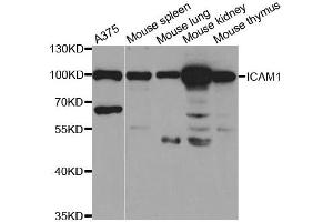 Western Blotting (WB) image for anti-Intercellular Adhesion Molecule 1 (ICAM1) antibody (ABIN1876800) (ICAM1 antibody)