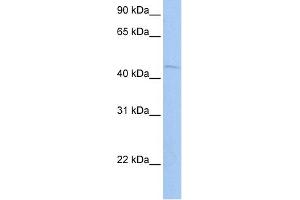 WB Suggested Anti-ZBTB6 Antibody Titration:  0. (ZBTB6 antibody  (N-Term))