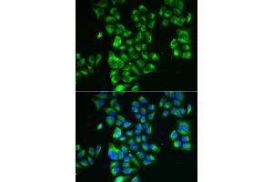 Immunofluorescence analysis of A549 cell using GLUD2 antibody. (GLUD2 antibody)