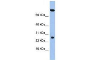 Image no. 1 for anti-Zinc Finger, SWIM-Type Containing 3 (ZSWIM3) (AA 35-84) antibody (ABIN6743750)