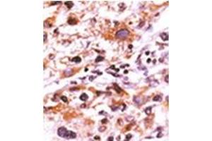 Image no. 1 for anti-Fibroblast Growth Factor Receptor 1 (FGFR1) (pTyr766) antibody (ABIN358128) (FGFR1 antibody  (pTyr766))