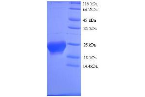 SDS-PAGE (SDS) image for N-Acylsphingosine Amidohydrolase (Non-Lysosomal Ceramidase) 2B (ASAH2B) (AA 1-165), (full length) protein (His tag) (ABIN5713262) (ASA2B Protein (AA 1-165, full length) (His tag))