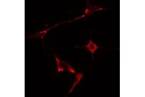ABIN6274672 staining HepG2 cells by IF/ICC. (HSPB2 antibody  (Internal Region))
