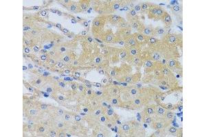 Immunohistochemistry of paraffin-embedded Mouse kidney using CABP7 Polyclonal Antibody at dilution of 1:100 (40x lens). (CABP7 antibody)