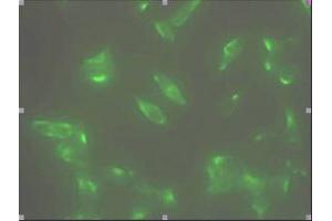 Immunofluorescence (IF) image for anti-Six Transmembrane Epithelial Antigen of The Prostate 1 (STEAP1) (AA 1-70), (N-Term) antibody (ABIN317568) (STEAP1 antibody  (N-Term))