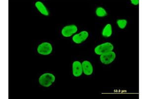 Immunofluorescence (IF) image for anti-Minichromosome Maintenance Complex Component 6 (MCM6) (AA 1-821) antibody (ABIN517783)