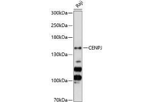 Western blot analysis of extracts of Raji cells, using CENPJ Antibody (ABIN6128980, ABIN6138409, ABIN6138410 and ABIN6224765) at 1:3000 dilution.