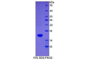SDS-PAGE (SDS) image for Coagulation Factor VII (F7) (AA 42-169) protein (His tag) (ABIN2120839) (Factor VII Protein (AA 42-169) (His tag))