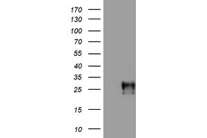 Western Blotting (WB) image for anti-Adiponectin (ADIPOQ) (AA 19-244) antibody (ABIN2715769) (ADIPOQ antibody  (AA 19-244))
