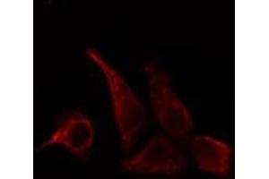 ABIN6278649 staining HepG2 cells by IF/ICC. (CD28 antibody  (pTyr218))