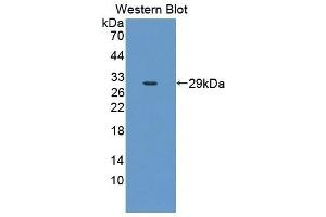 Detection of Recombinant CLTA, Mouse using Polyclonal Antibody to Clathrin, Light Polypeptide A (CLTA)