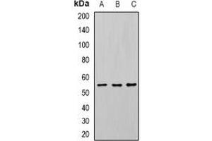 Western blot analysis of U2AF65 expression in Jurkat (A), SW620 (B), mouse spleen (C) whole cell lysates.